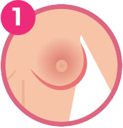 Red or thickened breast or areola